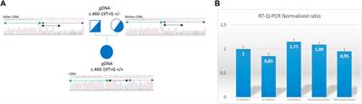 Recurrent “outsider” intronic variation in the SLC5A6 gene causes severe mixed axonal and demyelinating neuropathy, cyclic vomiting and optic atrophy in 3 families from Maghreb